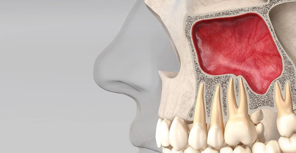 Anatomia do seio maxilar