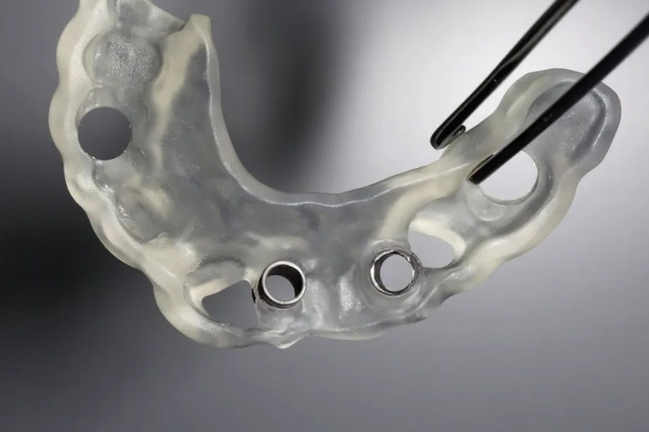 Fluxo digital em cirurgia guiada: as etapas e onde o erro entra