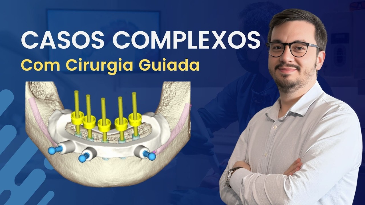 Cirurgia Guiada | Aplicação em Casos Complexos