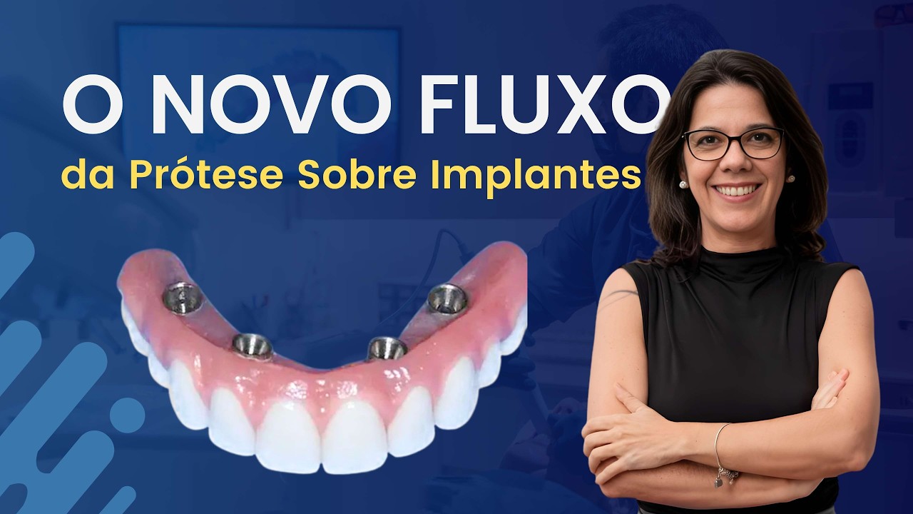 O Novo Fluxo da Prótese Sobre Implantes